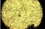 Des diatomées (phytoplancton)